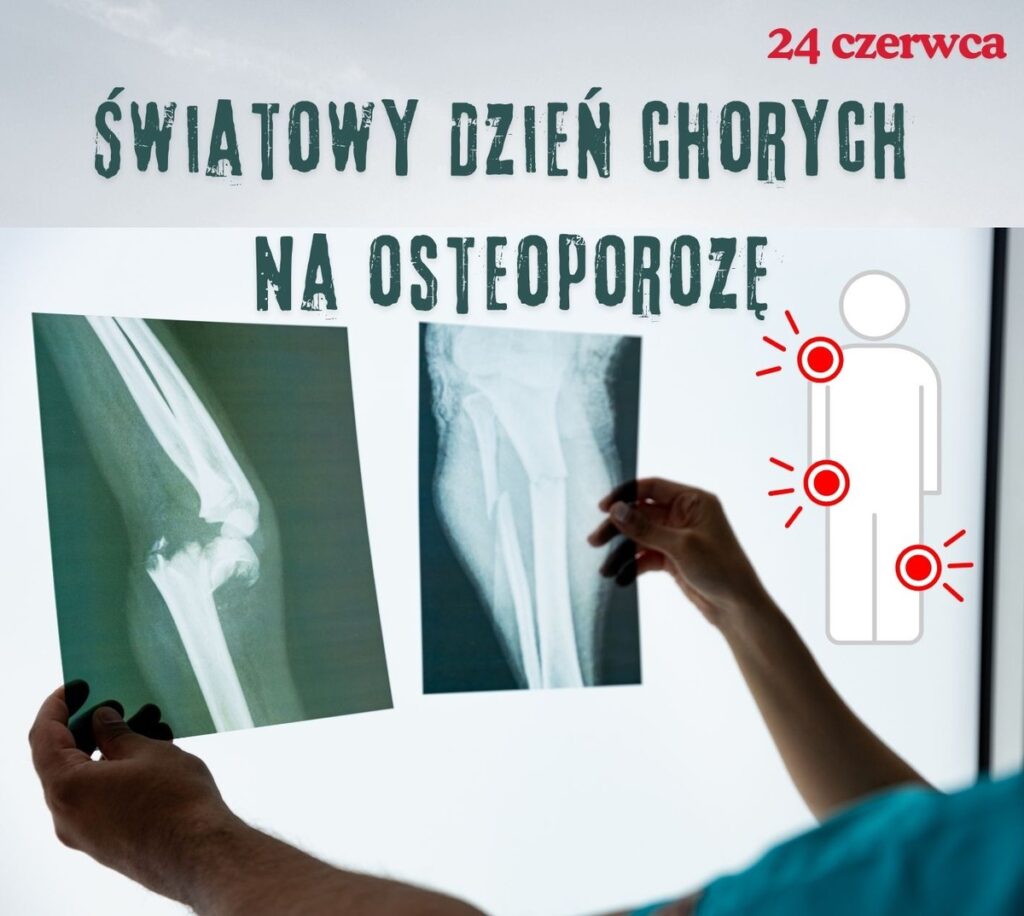 Na grafice ręce lekarza trzymające dwa zdjęcia rentgenowskie ze złamaniami na tle ekranu ze światłem oraz napis: 24 czerwca - światowy dzień chorych na osteoporozę.